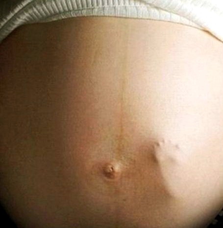 ножка. ножка отпечаталась на животе беременной женщины. веселая картинка для взрослых