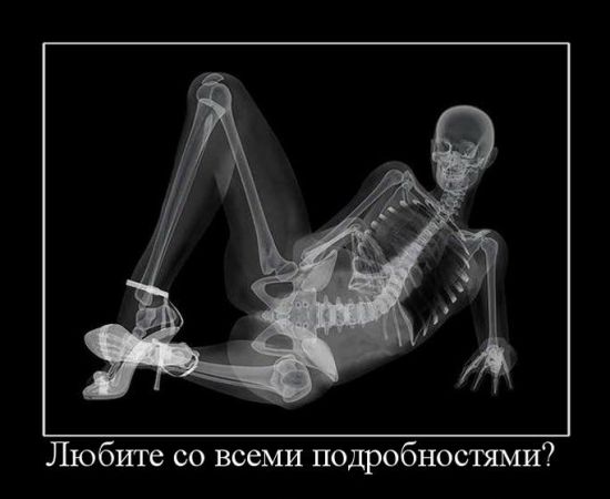 подробности одной любви. рентгеновский снимок внутренностей лежащей девушки. фото прикол эротический