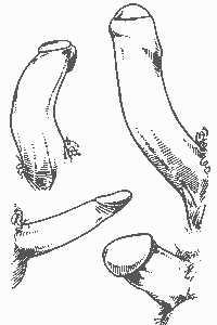 Разные формы эрегированных пенисов
